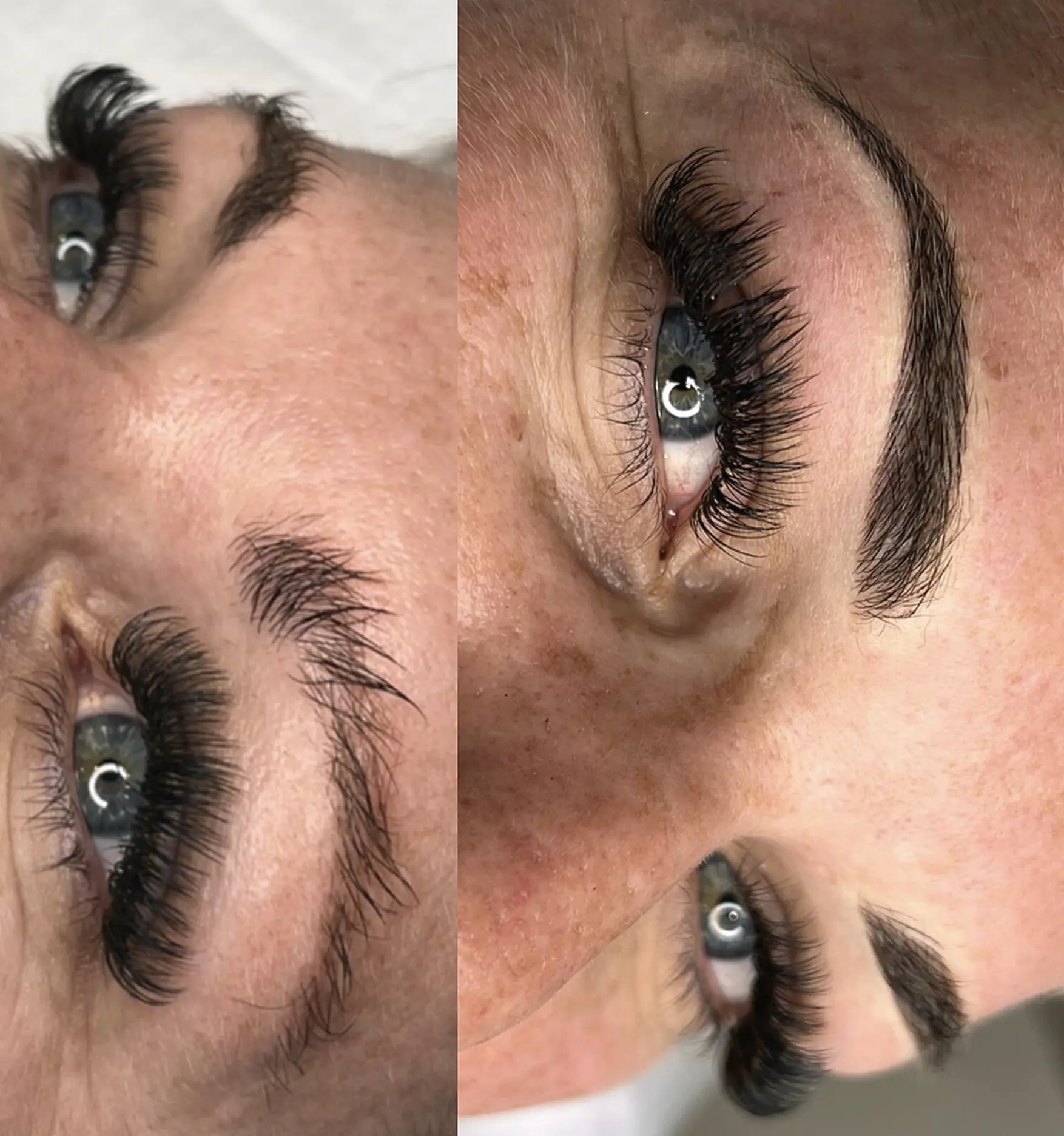 laser courses in Melbourne